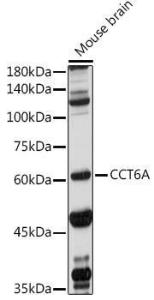 Western blot analysis of extracts of Mouse brain, using Anti-CCT6A Antibody (A9234) at 1:1,000 dilution. The secondary antibody was Goat Anti-Rabbit IgG H&L Antibody (HRP) at 1:10,000 dilution. Lysates/proteins were present at 25µg per lane.