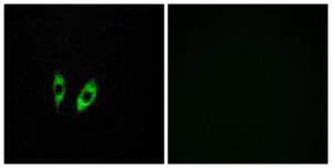 Anti-GPR156 antibody