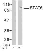 Anti-STAT6 Rabbit Polyclonal Antibody