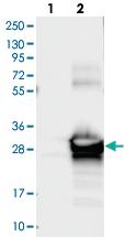 Anti-RP5-1000E10.4 Rabbit Polyclonal Antibody