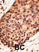 Anti-MMP16 Rabbit Polyclonal Antibody (Biotin)