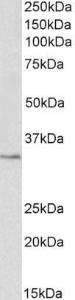 Anti-PCNA Antibody (A83563) (03 µg/ml) staining of Pig Spleen lysate (35 µg protein in RIPA buffer) Primary incubation was 1 hour Detected by chemiluminescence