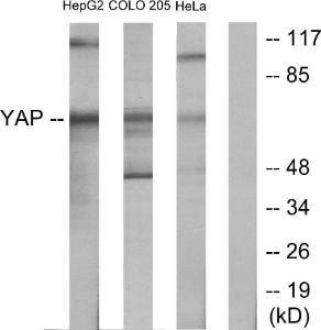 Western blot analysis of lysates from HeLa, HepG and COLO205 cells using Anti-YAP Antibody. The right hand lane represents a negative control, where the antibody is blocked by the immunising peptide.