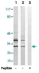 Anti-AIG1 Rabbit Polyclonal Antibody