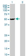 Anti-VRK2 Rabbit Polyclonal Antibody