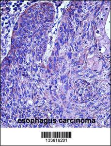 Anti-MMP3 Rabbit Polyclonal Antibody