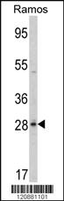 Anti-PGLS Rabbit Polyclonal Antibody