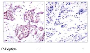 Anti-STAT6 Rabbit Polyclonal Antibody