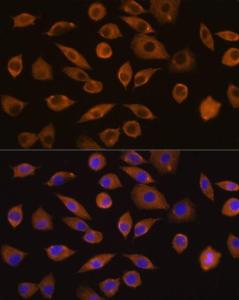 Antibody anti-DOCK2 100 µl