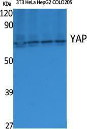 Western blot analysis of various cells using Anti-YAP Antibody