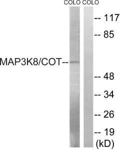 Anti-MAP3K8 Rabbit Polyclonal Antibody