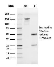 SDS-PAGE analysis of Anti-ICAM3 Antibody [rICAM3/1019] under non-reduced and reduced conditions; showing intact IgG and intact heavy and light chains, respectively. SDS-PAGE analysis confirms the integrity and purity of the antibody