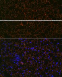 Immunofluorescence analysis of mouse brown adipose using Anti-Perilipin-1 Antibody [ARC1122] (A306256) at a dilution of 1:100 (40X lens). DAPI was used to stain the cell nuclei (blue)