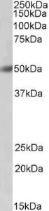 Anti-BPI Antibody (A85221) (03 µg/ml) staining of Human Bone Marrow lysate (35 µg protein in RIPA buffer) Primary incubation was 1 hour Detected by chemiluminescence