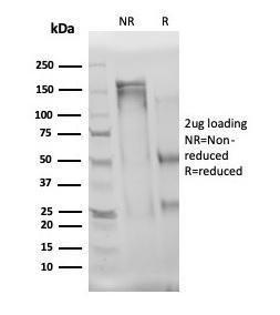 SDS-PAGE analysis of Anti-IL-3 Antibody [IL3/4004] under non-reduced and reduced conditions; showing intact IgG and intact heavy and light chains, respectively. SDS-PAGE analysis confirms the integrity and purity of the antibody.