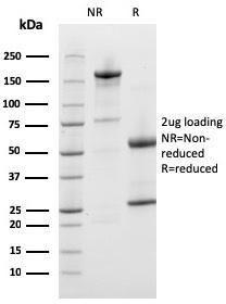 Anti-Prohibitin antibody