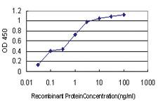 Anti-ANAPC11 Mouse Monoclonal Antibody [clone: 1B4-1A4]