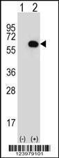 Anti-GK Rabbit Polyclonal Antibody (AP (Alkaline Phosphatase))