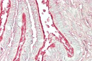 Anti-Arl6 Antibody (A83566) (5 µg/ml) staining of paraffin embedded Human Lung Steamed antigen retrieval with citrate buffer pH 6, AP-staining