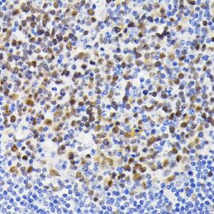 Immunohistochemistry analysis of paraffin-embedded human tonsil using Anti-NFAT2 Antibody (A93268) at a dilution of 1:200 (40X lens)