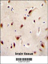 Anti-IQCJ Rabbit Polyclonal Antibody