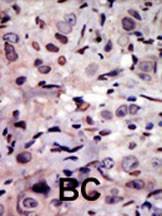 Anti-ALK Rabbit Polyclonal Antibody