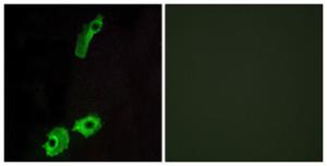 Immunofluorescence analysis of HeLa cells using Anti-GPR151 Antibody. The right hand panel represents a negative control, where the Antibody was pre-incubated with the immunising peptide