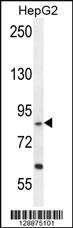 Anti-EXOC3L Rabbit Polyclonal Antibody [clone: 153CT43.1.1]