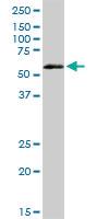 Anti-VRK2 Rabbit Polyclonal Antibody