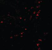 Anti-LAMP1 Rabbit Polyclonal Antibody