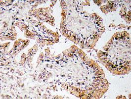 Anti-CALCA Rabbit Polyclonal Antibody