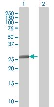 Anti-ZC3HC1 Mouse Polyclonal Antibody