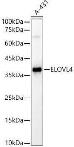 Anti-ELOVL4 antibody