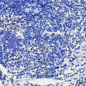 Immunohistochemistry analysis of paraffin-embedded human appendix tissue using Anti-NFAT2 Antibody (A93268) at a dilution of 1:200 (40X lens)