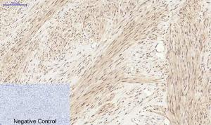 Immunohistochemical analysis of paraffin-embedded human uterus tissue using Anti-YAP Antibody at 1:200 (4°C overnight). Negative control was secondary antibody only.