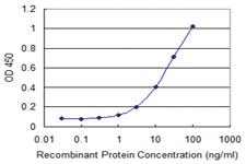 Anti-MIEN1 Mouse Monoclonal Antibody [clone: 3B5]