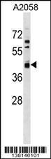 Anti-AMDHD2 Rabbit Polyclonal Antibody