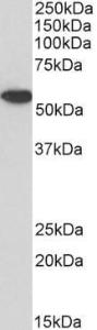 Anti-ANXA11 Antibody (A83568 / Biotin) (1 µg/ml) staining of Jurkat lysate (35 µg protein in RIPA buffer), exactly mirroring its parental non-biotinylated product