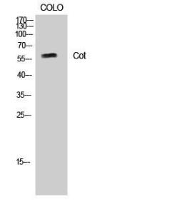 Anti-MAP3K8 Rabbit Polyclonal Antibody