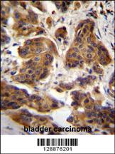 Anti-C4orf21 Rabbit Polyclonal Antibody [clone: 153CT43.1.1]