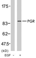 Anti-PGR Rabbit Polyclonal Antibody