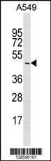 Anti-GYG2 Rabbit Polyclonal Antibody (Biotin)