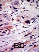 Anti-ALK Rabbit Polyclonal Antibody