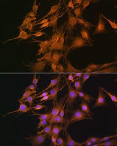 Anti-ELOVL4 antibody