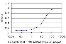 Anti-NHLH2 Mouse Monoclonal Antibody [clone: 3E11]