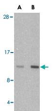 Anti-HRK Rabbit Polyclonal Antibody