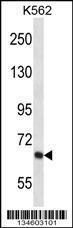 Anti-KCND2 Rabbit Polyclonal Antibody (HRP (Horseradish Peroxidase))