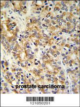 Anti-TXNDC12 Rabbit Polyclonal Antibody (FITC (Fluorescein Isothiocyanate))