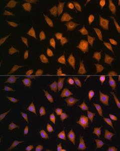 Anti-ELOVL4 antibody