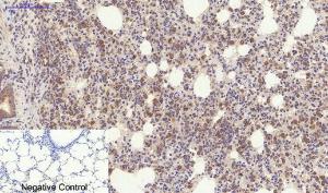 Immunohistochemical analysis of paraffin-embedded rat lung tissue using Anti-YAP Antibody at 1:200 (4°C overnight). Negative control was secondary antibody only.